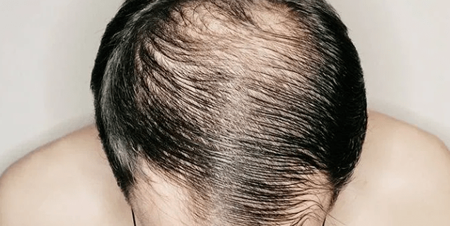 Merész a férfiakban